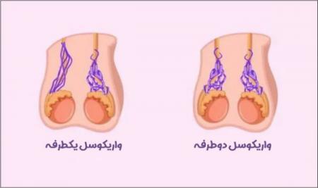 جراحی پروستات، جراحی سنگ کلیه و واریکوسل: راهنمای کامل برای تشخیص و درمان