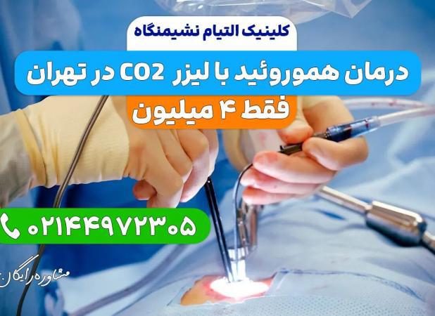 لیزر هموروئید در کلینیک التیام نشیمنگاه