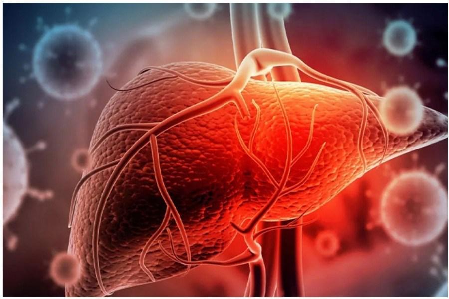 کمتر از 1 درصد جمعیت ایران به "هپاتیت B" مبتلا هستند