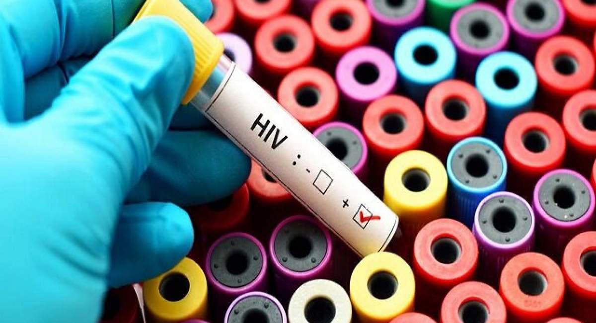 نتایج پویش اخیر وزارت بهداشت درباره HIV