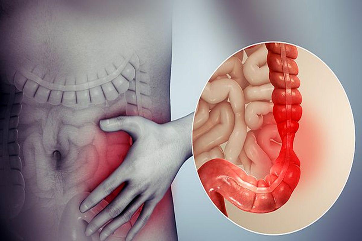 یک عروسی در روستا ۲۰۰ نفر را راهی بیمارستان کرد و مدارس تعطیل شدند