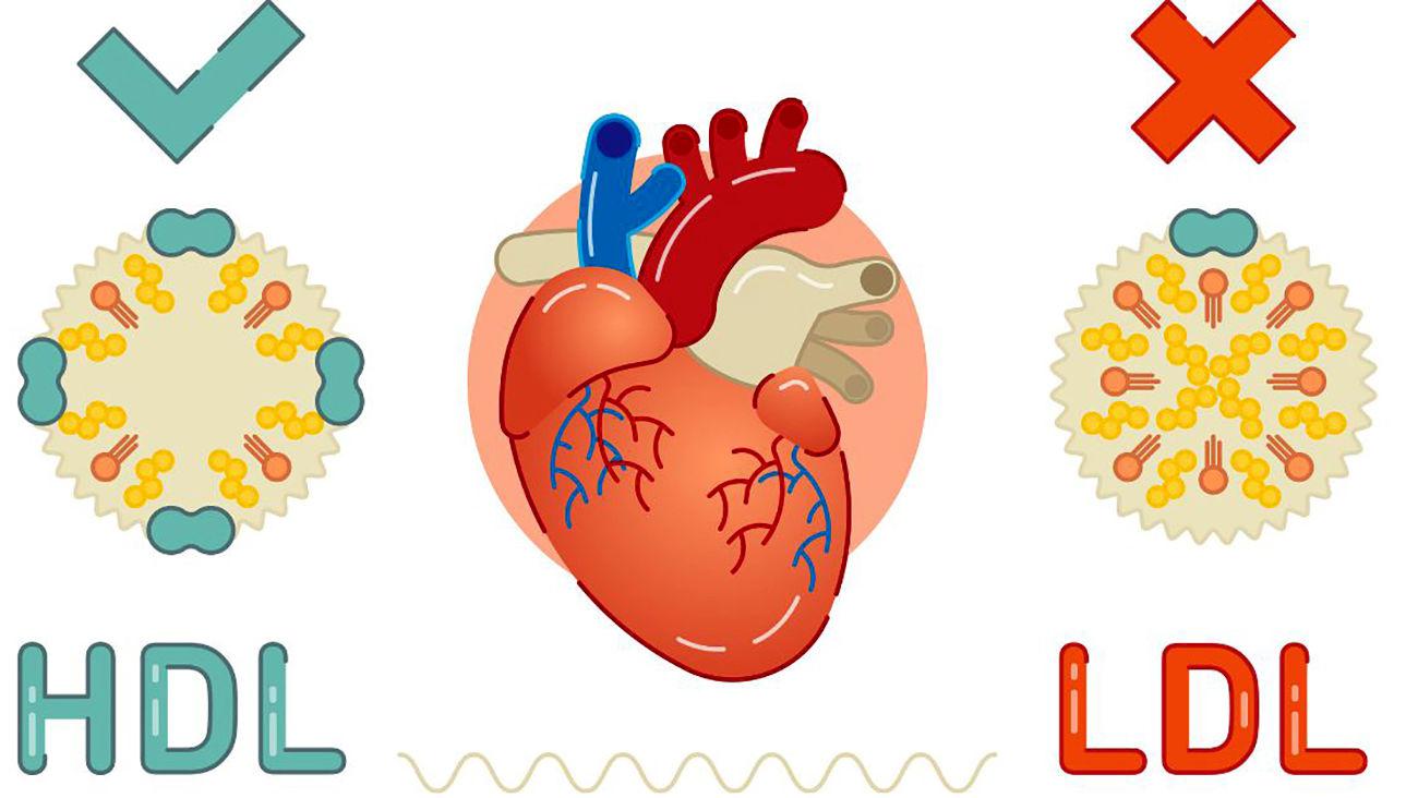 ال دی ال (LDL ) در آزمایش خون چیست؟ / جدول راهنمای سطح ال دی ال خون