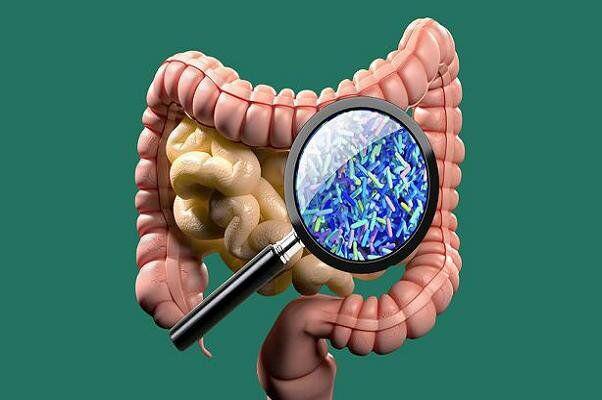 تغییرات میکروبیوم روده ممکن است علت آرتریت روماتوئید باشد