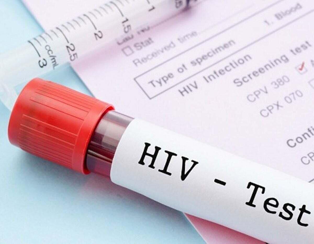 آزمایش رایگان و محرمانه HIV؛ جزییات مراکز تست اچ‌آی‌وی