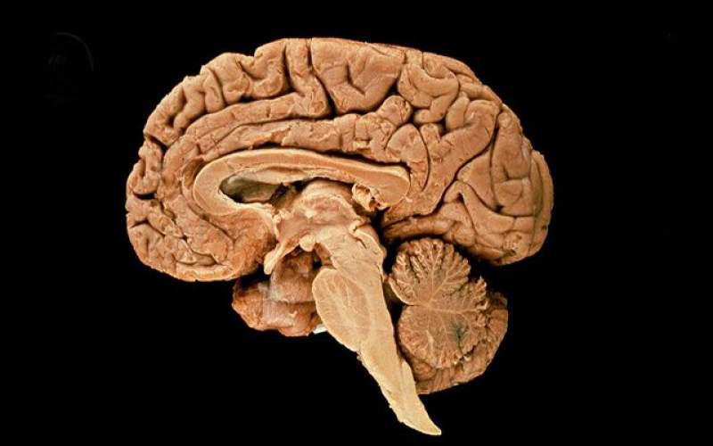 چگونه مغز انسان تا این اندازه بزرگ شد؟