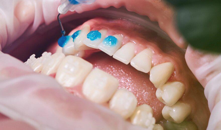 ببینید   شوکه شدن دندان‌پزشک از اقدام عجیب یک مرد برای جلوگیری از افتادن دندان‌هایش